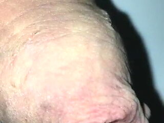 Foreskin # Hot Beer and Thick Milk