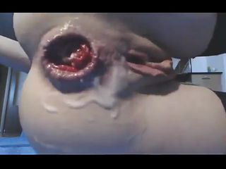 Punchfisting and gape