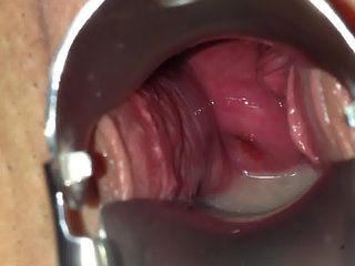 Spekulum nach ihrer Besamung