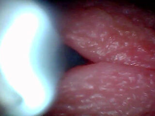 Endoscope Camera Captures Moment of Male Ejaculation 4K