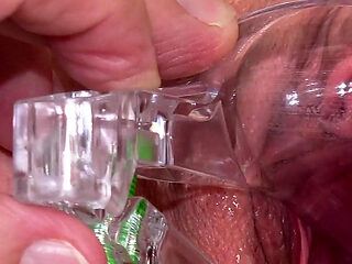 Big Clit Pussy Examined with Speculum