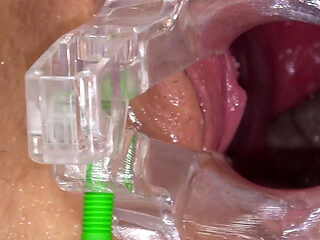 Pussy Exam of Hot College Student Juliia